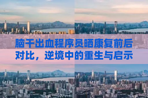 脑干出血程序员晒康复前后对比，逆境中的重生与启示